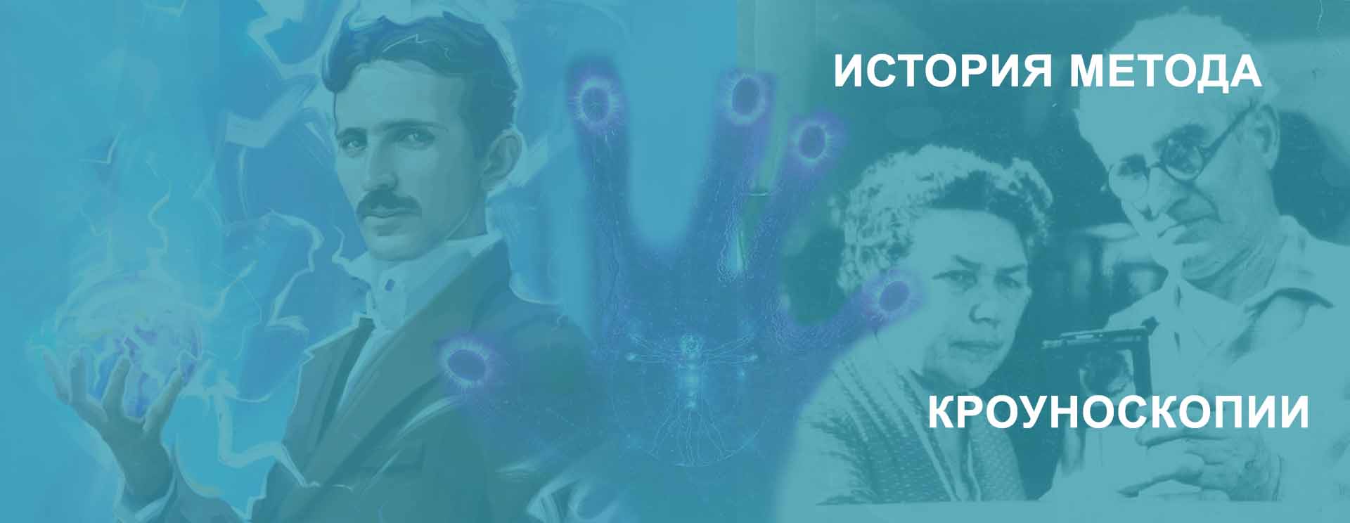 История метода